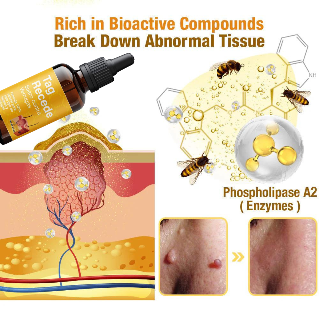 TRATAMIENTO PARA VERRUGAS Y LUNARES🐝👨⚕